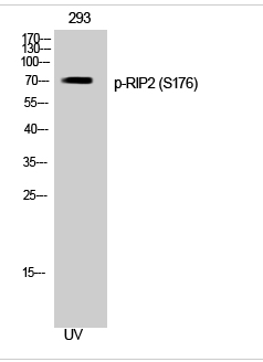 RIP2 (phospho Ser176) Polyclonal Antibody