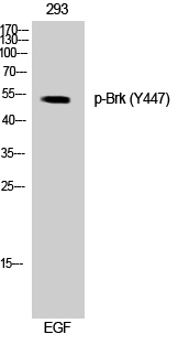 Brk (phospho Tyr447) Polyclonal Antibody