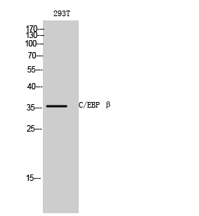 C/EBP β Polyclonal Antibody