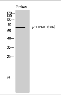 TIP60 (phospho Ser86) Polyclonal Antibody
