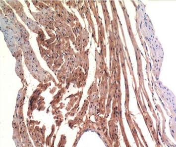 VE-Cadherin Mouse Monoclonal Antibody(8E5)