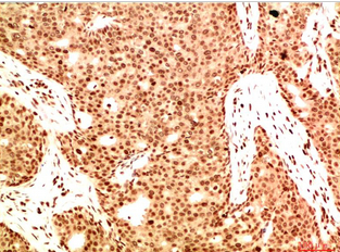 Acetyl NF kB P65（K314/K315) Mouse Monoclonal Antibody(5G11)