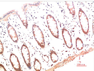 Collagen I Mouse Monoclonal Antibody(4B5)