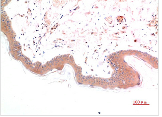 Phospho-Smad3(S425) Mouse Monoclonal Antibody(1D9)