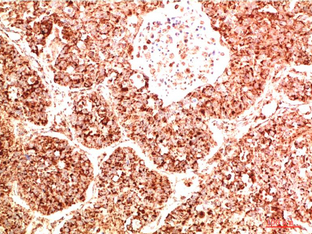 FAK Rabbit Polyclonal Antibody