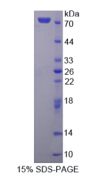 Recombinant Farnesyl Diphosphate Synthase (FDPS)