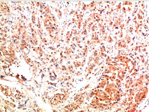 ERK1 Rabbit Polyclonal Antibody