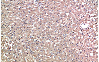 TTR Mouse Monoclonal Antibody(1D7)