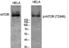 mTOR (phospho Thr2446) Polyclonal Antibody