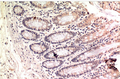 Gamma Tubulin Mouse Monoclonal Antibody(4A4)