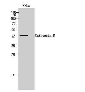 Cathepsin D Polyclonal Antibody