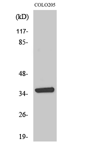 AASD-PPT Polyclonal Antibody