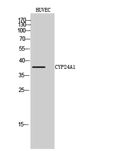 CYP24A1 Polyclonal Antibody