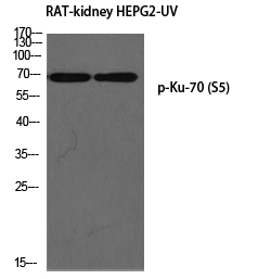 Ku-70 (phospho Ser5) Polyclonal Antibody