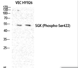SGK1 (phospho Ser422) Polyclonal Antibody