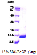 ACBP, 1-87aa, Human, His tag, E Coli