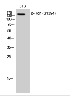 Ron (phospho Ser1394) Polyclonal Antibody