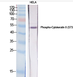 Cytokeratin 8 (phospho Ser73) Polyclonal Antibody