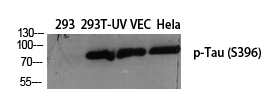 Tau (phospho Ser396) Polyclonal Antibody