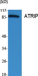 ATRIP Polyclonal Antibody