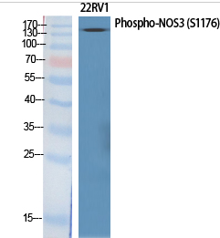 NOS3 (phospho Ser1177) Polyclonal Antibody