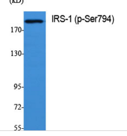 IRS-1 (phospho Ser794) Polyclonal Antibody