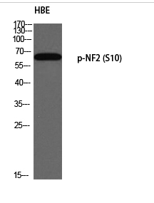 NF2 (phospho Ser10) Polyclonal Antibody