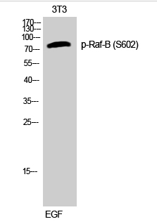 Raf-B (phospho Ser602) Polyclonal Antibody