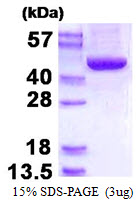 ACADSB, 34-432aa, Human, His tag, E Coli