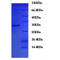 Recombinant Human Interleukin-6/IL-6