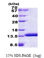 ABRACL, 1-81aa, Human, His tag, E Coli