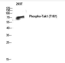 Tak1 (phospho Thr187) Polyclonal Antibody