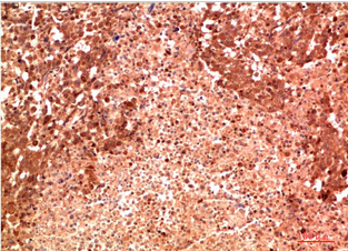 P38 Mouse Monoclonal Antibody(8C11)