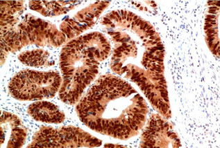 HSP40 Rabbit Polyclonal Antibody