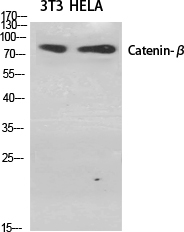Catenin-β Polyclonal Antibody