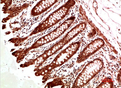 ATM Rabbit Polyclonal Antibody