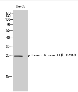 Casein Kinase IIβ (phospho Ser209) Polyclonal Antibody