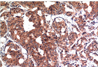 GSK3β Mouse Monoclonal Antibody(4D2)