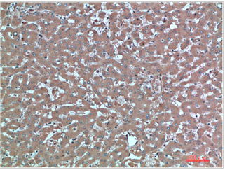 TTR Mouse Monoclonal Antibody(4A12)