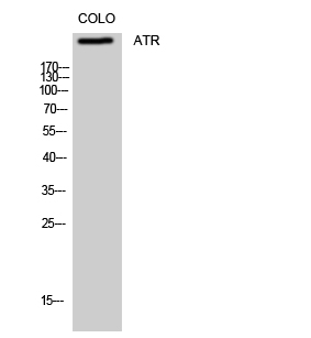 ATR Polyclonal Antibody