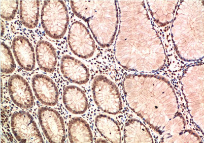 ATM Mouse Monoclonal Antibody(4G9)