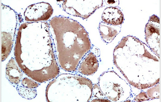 TTR Mouse Monoclonal Antibody(4E4)
