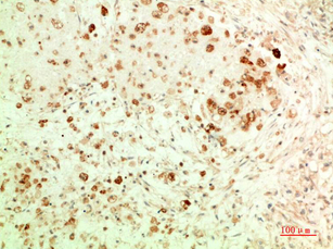 ATG5 Mouse Monoclonal Antibody(3C7)