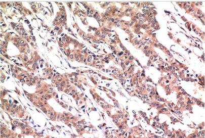 Phospho-Stat3 (Y705) Mouse Monoclonal Antibody(1E9)
