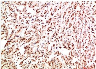 Gab1 Rabbit Polyclonal Antibody