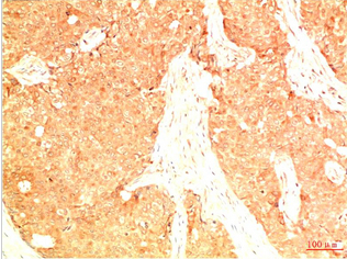 Acetyl P53(K382) Mouse Monoclonal Antibody(15F4)