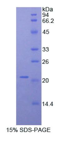 Recombinant A Disintegrin And Metalloproteinase With Thrombospondin 12 (ADAMTS12