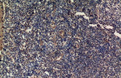 ERK1 Mouse Monoclonal Antibody(5E9)