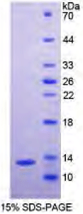 Recombinant A Disintegrin And Metalloproteinase With Thrombospondin 7 (ADAMTS7)