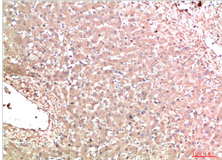 TTR Mouse Monoclonal Antibody(5D2)